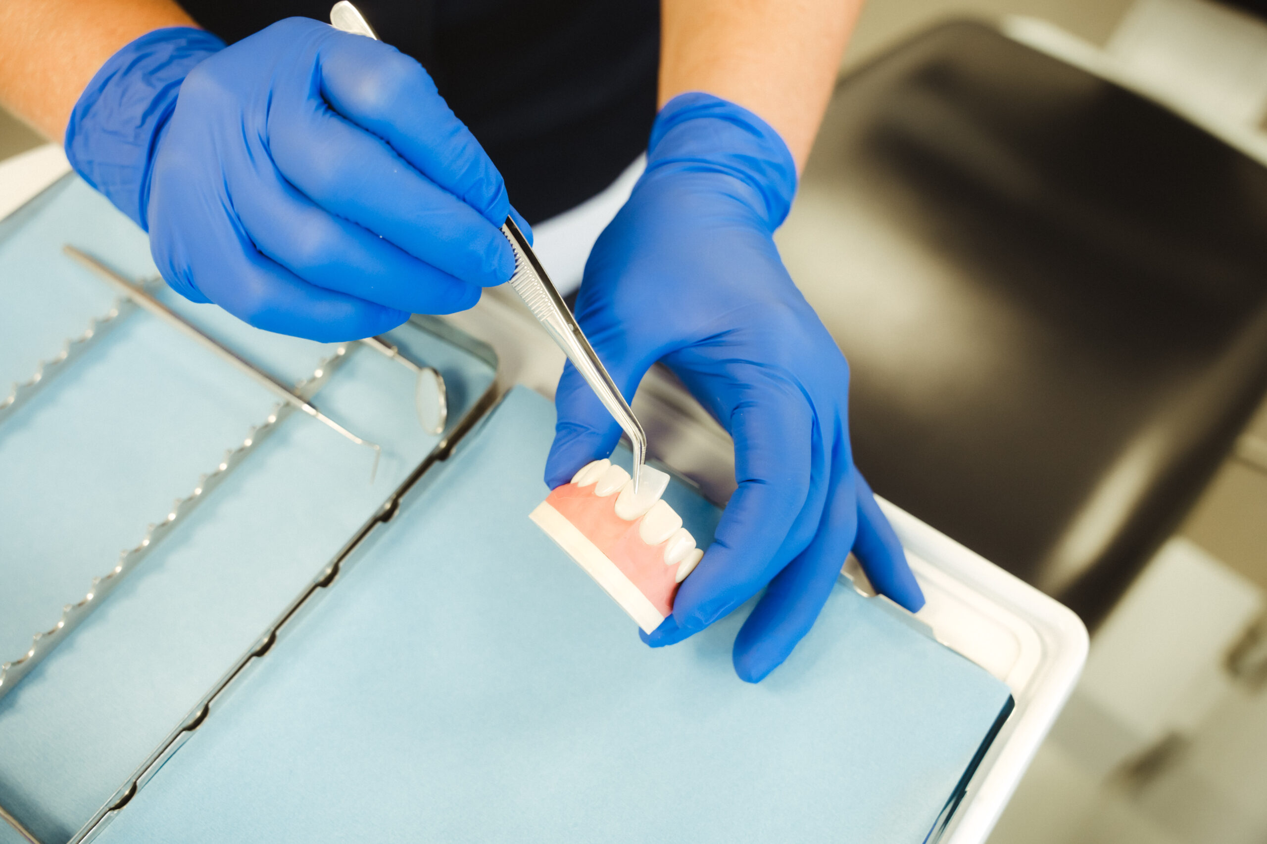 Veneers M&ouml;nchengladbach Dr. Jansen-Schick