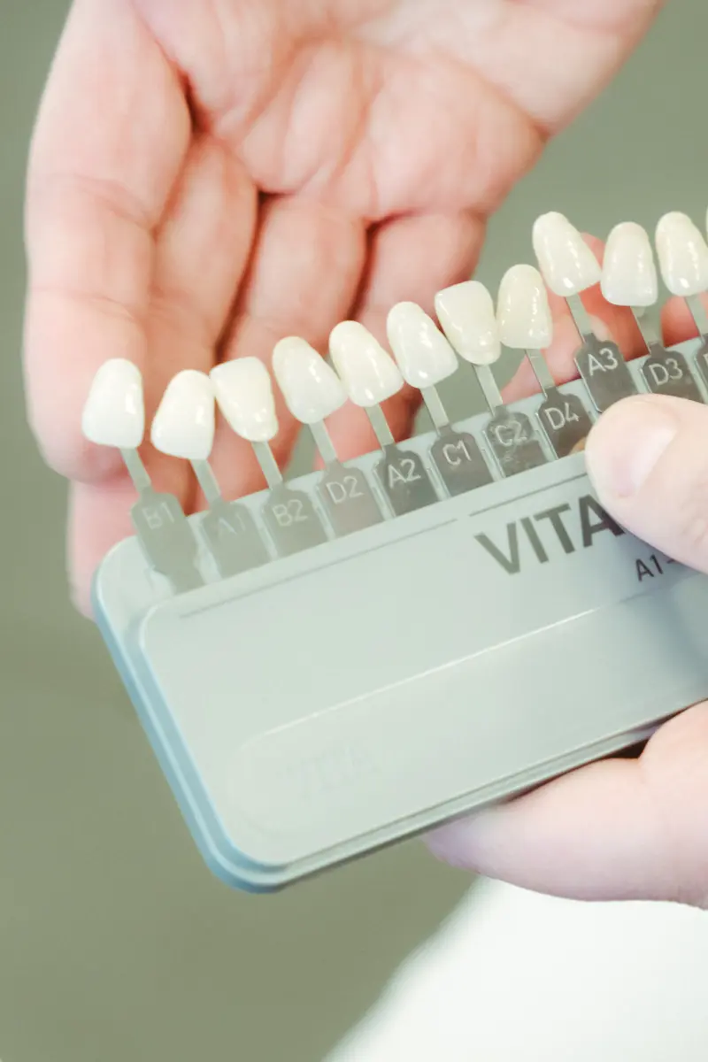 Zahnarztpraxis Dr. Jansen-Schick – Bleaching FAQ